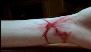suicidio01